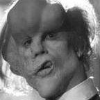 Joseph Merrick Photo 6