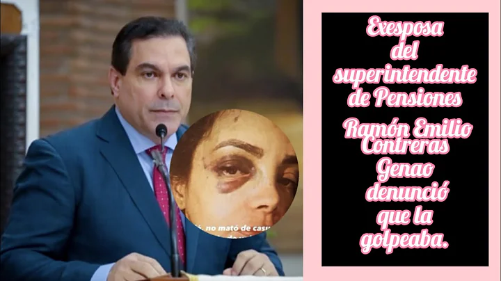 Emilio Contreras Photo 32