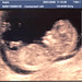 Elliott Little Photo 23