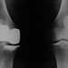 Michael Knee Photo 25