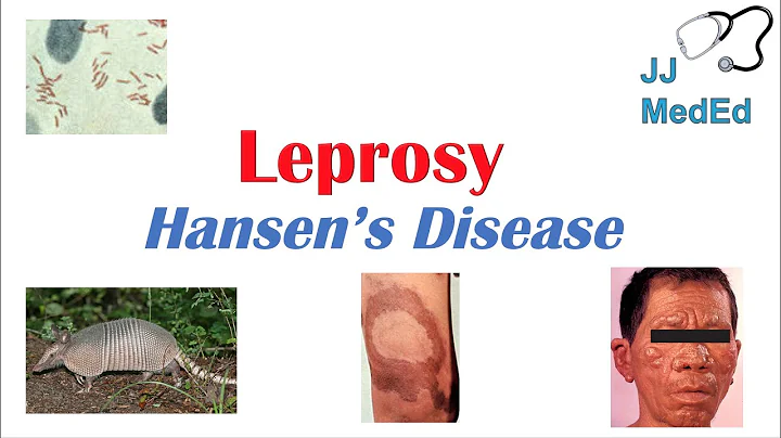 Lien Hansen Photo 13