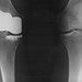Michael Knee Photo 24